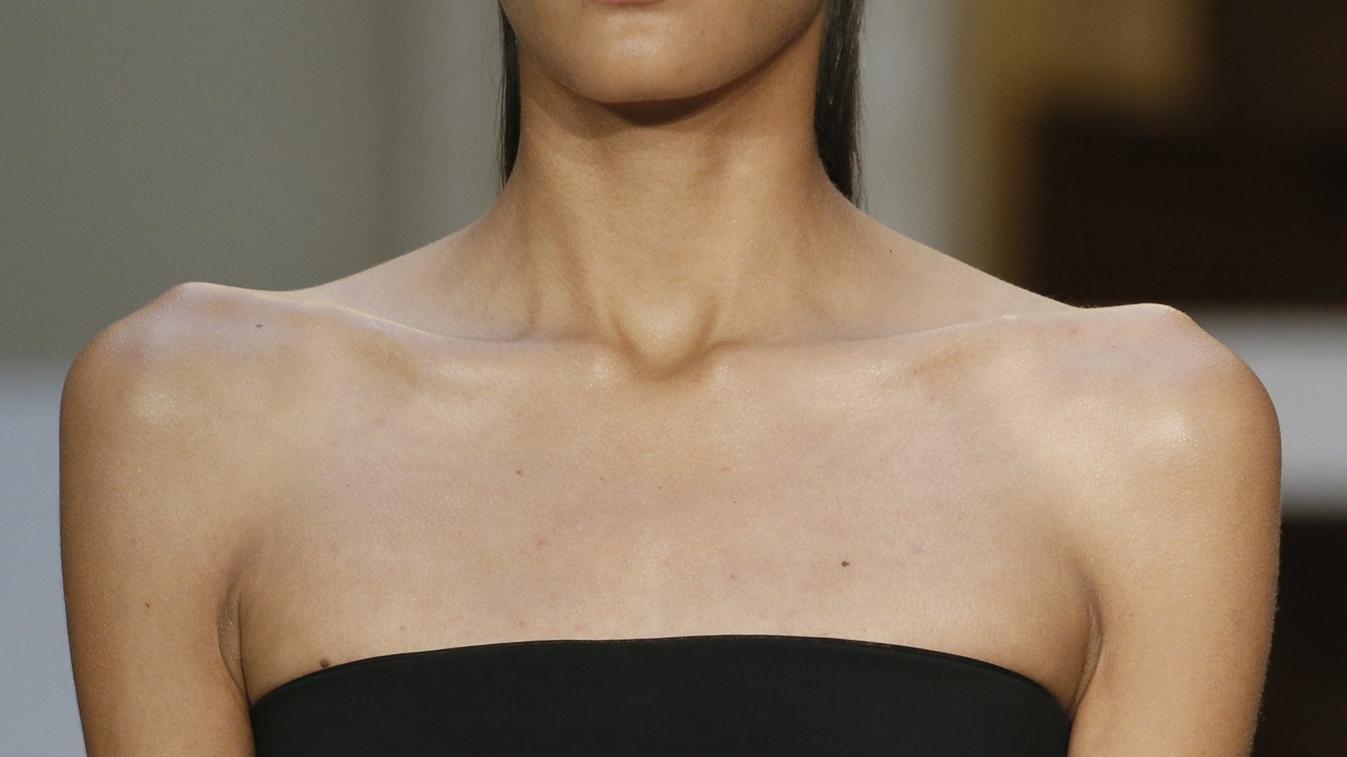 Γαλλία: Μία στις πέντε εφήβους είναι υπερβολικά αδύνατη