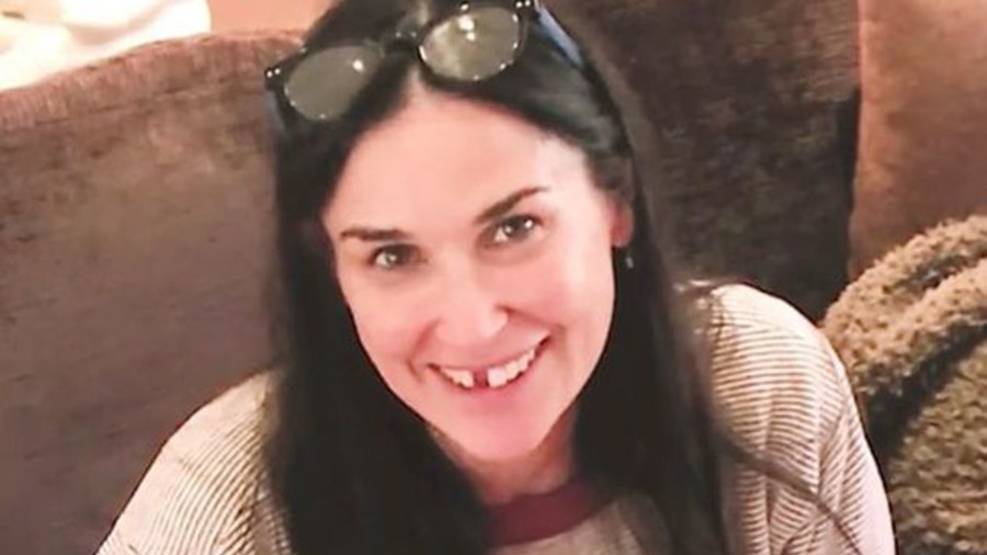 Η Ντέμι Μουρ αποκάλυψε γιατί έχασε τα μπροστινά της δόντια – ΒΙΝΤΕΟ