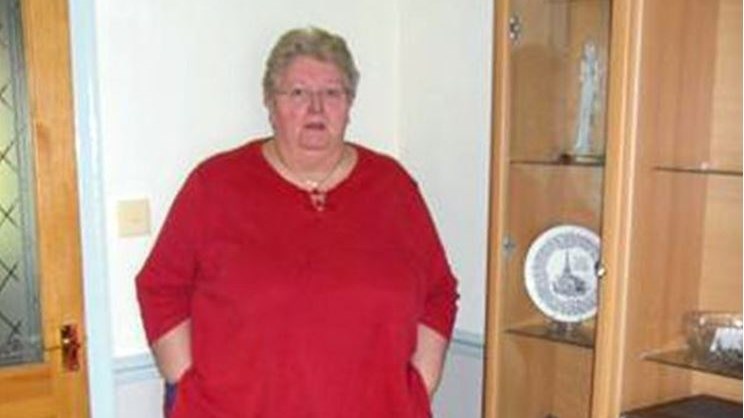 Η γυναίκα αυτή δεν έκανε μπάνιο επί 20 χρόνια επειδή φοβόταν ότι… – ΦΩΤΟ