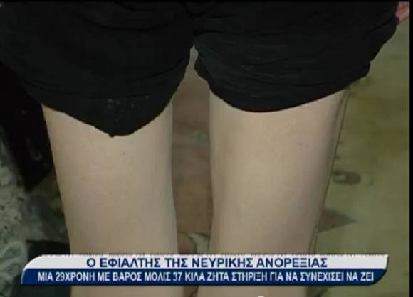 “Σβήνει” από νευρική ανορεξία