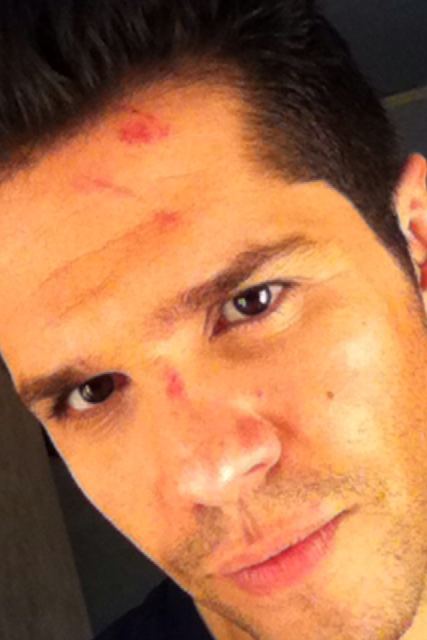 Ο “τραυματίας” Τσαλίκης