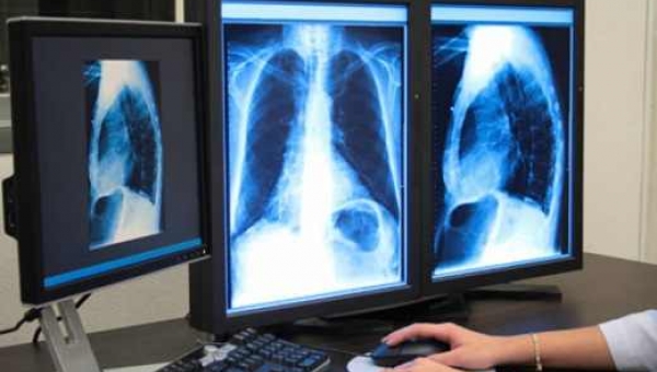 Παίδων-Λουκέτο στο ακτινολογικό