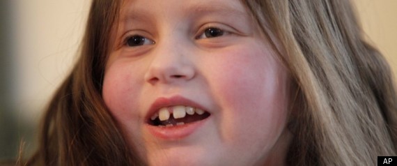 Ζει με 6 μεταμοσχευμένα όργανα