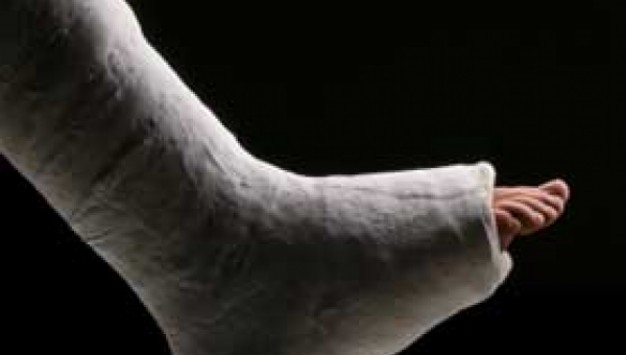 ΕΔΕ για τον γύψο