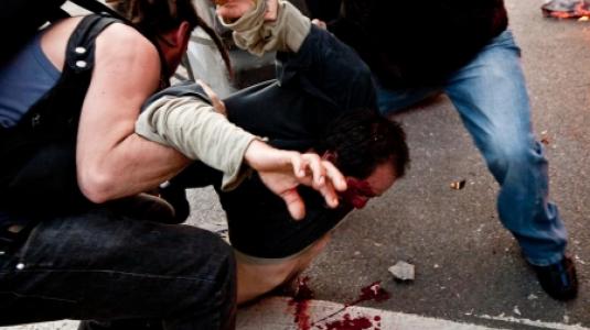 Εικόνες σοκ!