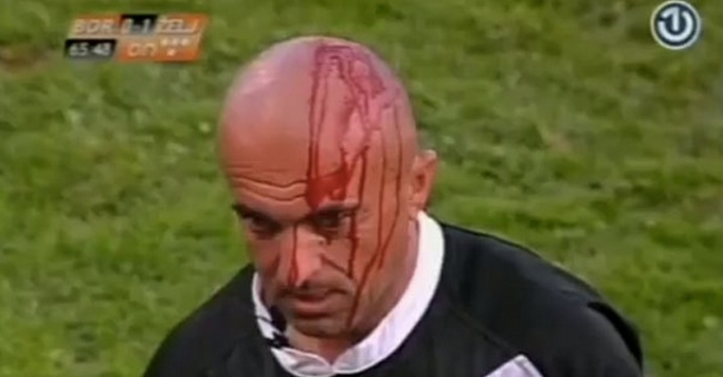 Του άνοιξαν το κεφάλι!