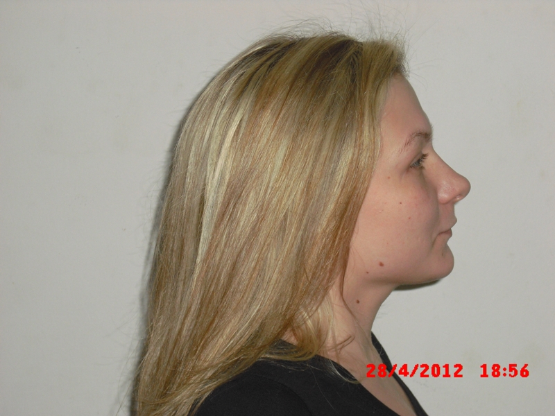 “Μοίραζε” AIDS