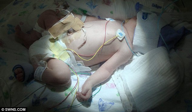 Γεννήθηκε χωρίς αίμα!