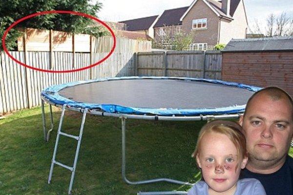 Σκύλος επιτέθηκε σε 5χρονη