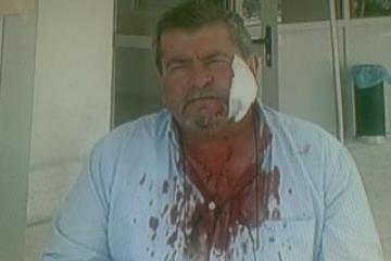 Οι ταχυδρόμοι στο στόχαστρο