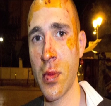 Χτύπησαν δημοσιογράφο