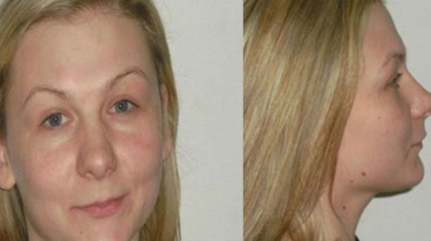 Ζητεί νέες εξετάσεις