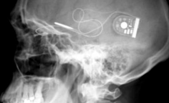 Τυφλοί βρήκαν το φως τους