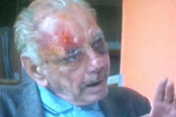 Τον χτύπησαν για 50 ευρώ