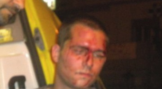 24χρονος πίσω από την επίθεση