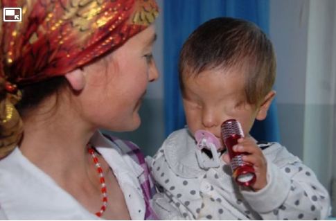 Γεννήθηκε χωρίς μάτια