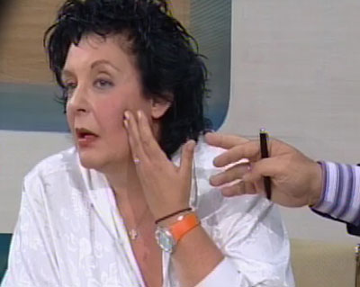 Τα σημάδια στο πρόσωπο της Λιάνας Κανέλλη