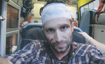 Κι άλλος ξυλοδαρμός ρεπόρτερ