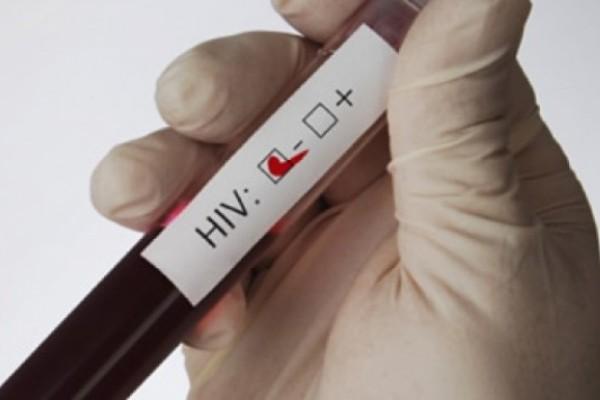 Δωρεάν εξέταση AIDS σε 20′