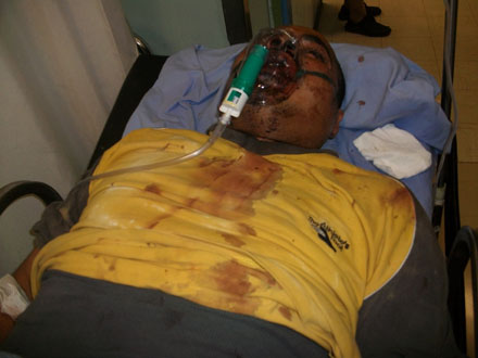 Απολογήθηκαν για την επίθεση