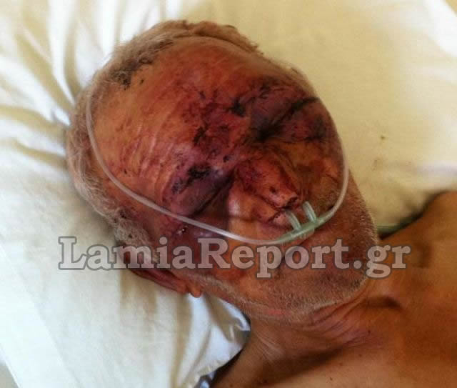 Aνθρωπόμορφα κτήνη