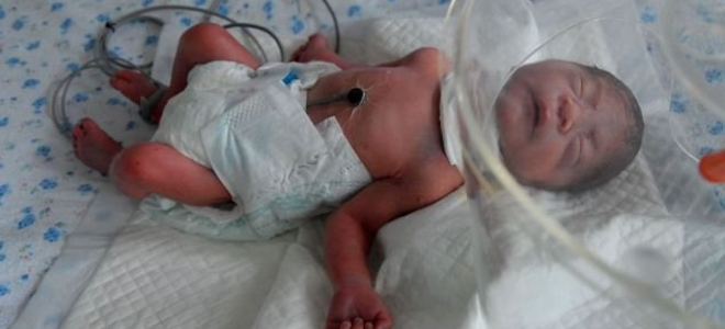 Έκοψαν το λαιμό βρέφους!