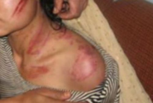 Την έδειρε στη μέση του δρόμου