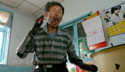 Έφτιαξε τεχνητά μέλη από σκραπ