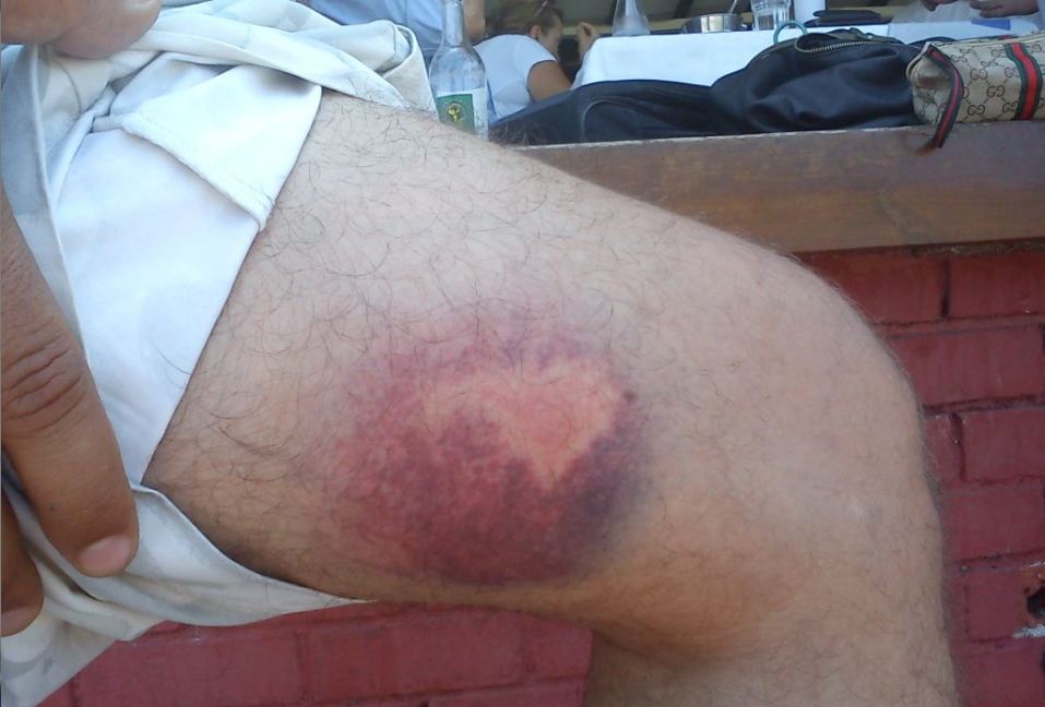 Είναι ή δεν είναι πλαστικές σφαίρες