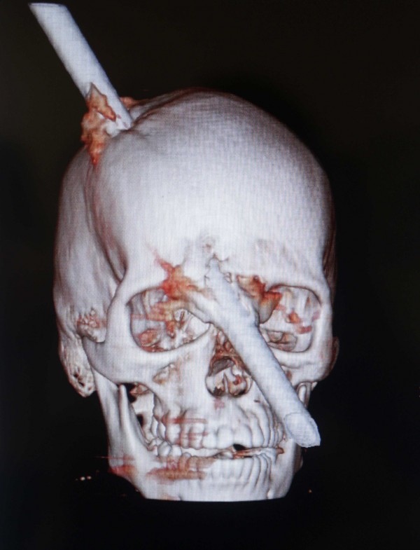 Σώθηκε από θαύμα