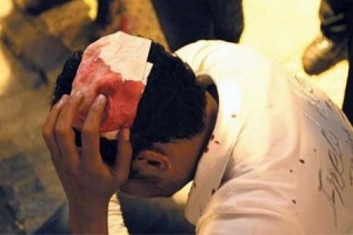 “Μια ανάσα” από τη σύλληψη