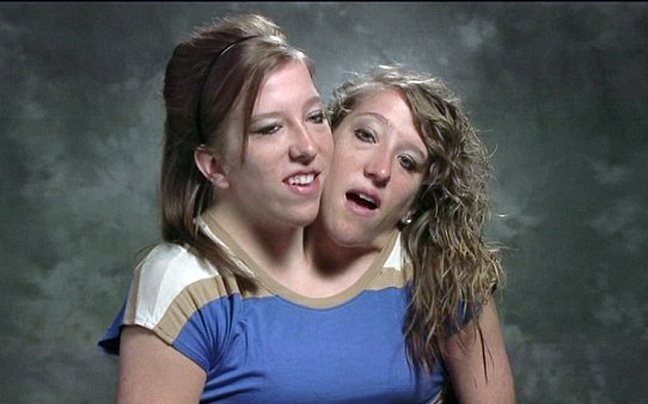 Reality για σιαμαίες