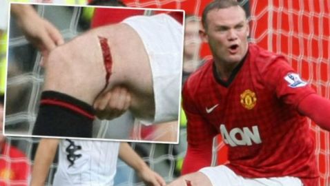 Αν ήταν ένα χιλιοστό πιο βαθιά…