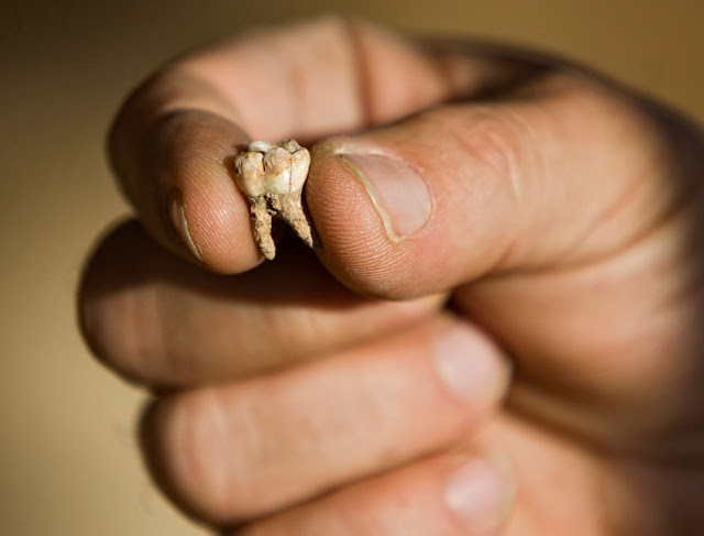 Σφραγισμένο δόντι…6.500 ετών!