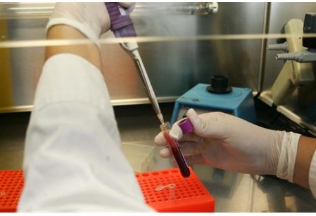 33 κρούσματα του Δυτικού Νείλου