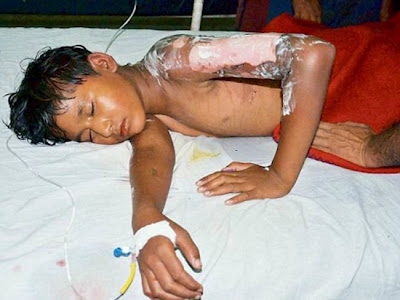 Τον έριξε στο καζάνι με το γάλα