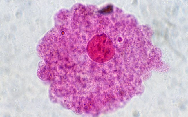 Ιός “Αρμαγεδδών”