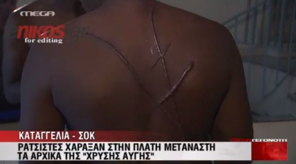 Του χάραξαν τα αρχικά της Χρυσής Αυγής