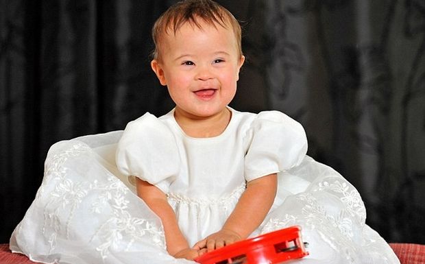 Θεραπεία για το Σύνδρομο Ντάουν