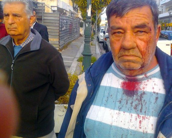 Τον έδειρε και μετά του έκοψε το ρεύμα(!)