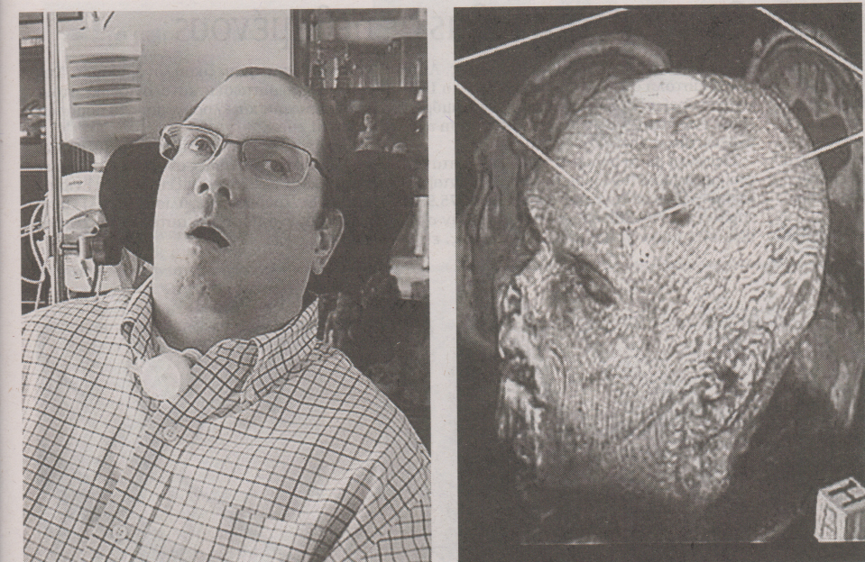 “Μίλησε” με τη σκέψη του