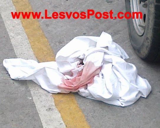 Άλμα θανάτου για νεαρή γυναίκα