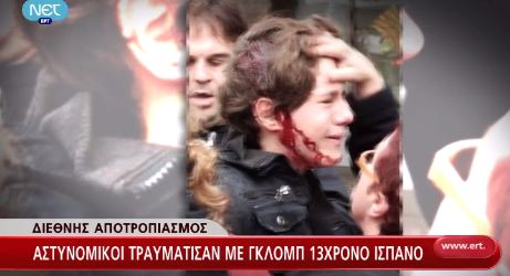 Χτύπησαν 13χρονο τα ισπανικά ΜΑΤ