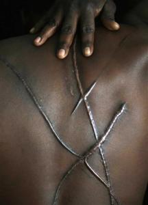 Η βία πέρα από το ρατσισμό