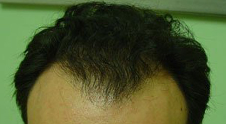 Το βάφει το μαλλί ο υπουργός;