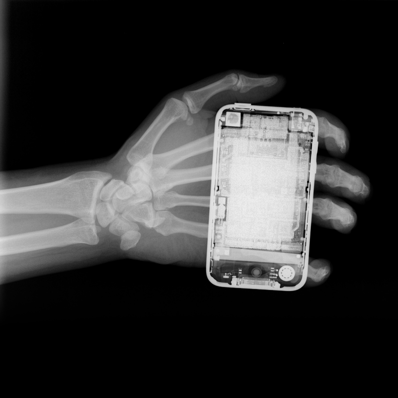 Κινητά θα βγάζουν… ακτινογραφίες