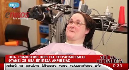 Ρομποτικό χέρι για τετραπληγικούς