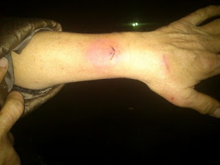 Ζήτησε απόδειξη και τη δάγκωσαν!