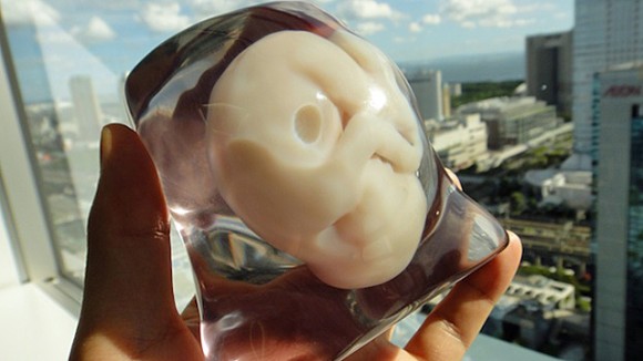 Νέα μέθοδος με 3D υπερήχους