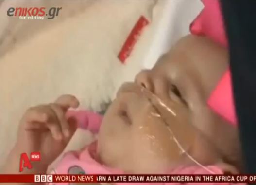 Γεννήθηκε με την καρδιά έξω από το στήθος